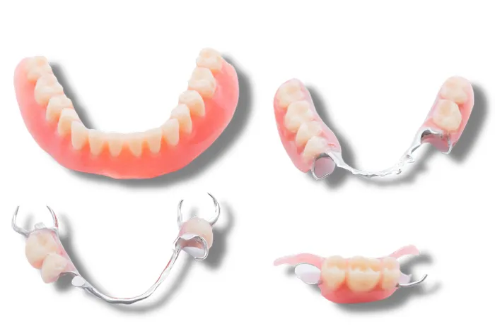 Removable Prosthetics