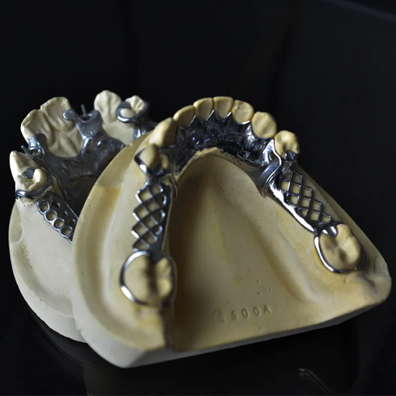 Titanium Hybrid Dentures