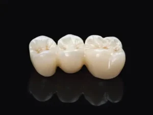 Monolithic Zirconia
