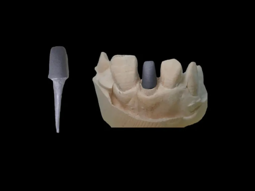 Zirconia Post & Core